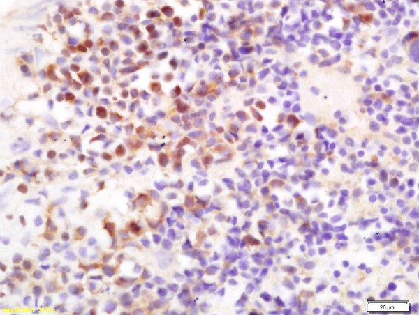 通用黄曲霉毒素单克隆抗体