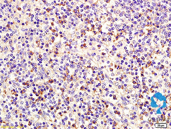 甲氰菊酯单克隆抗体