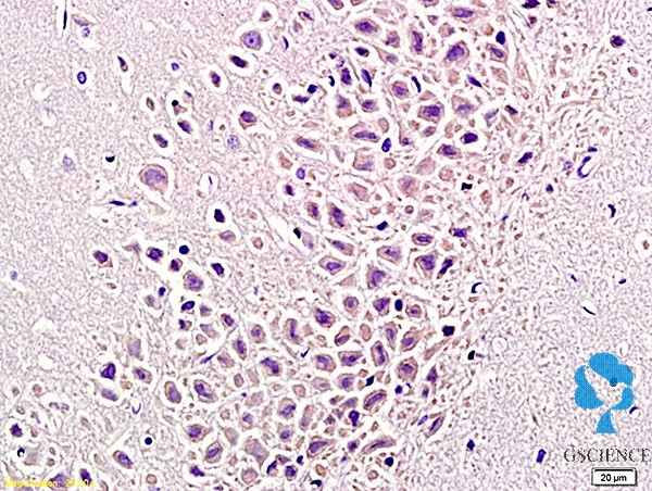 对位呋喃妥因代谢物单克隆抗体