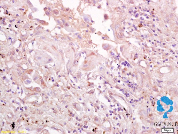 4-氯苯氧乙酸单克隆抗体