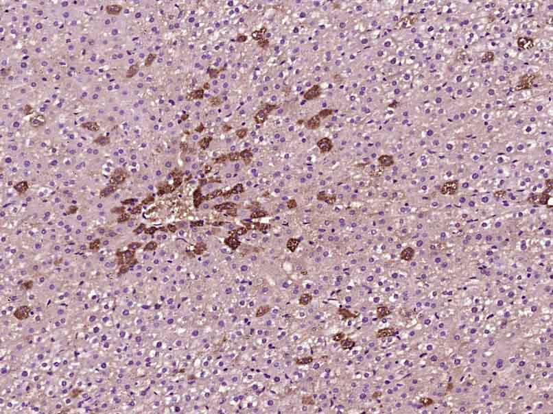 Mouse Anti-Phosphotyrosine antibody